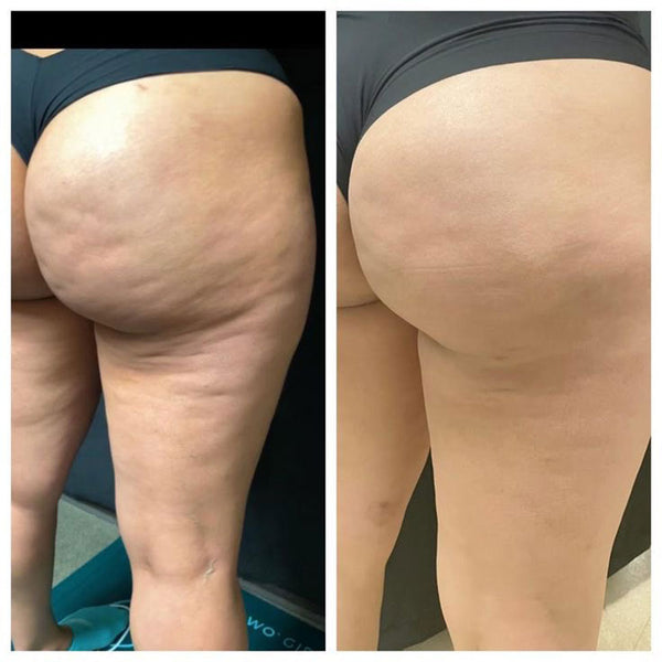Sophie, 49 ans